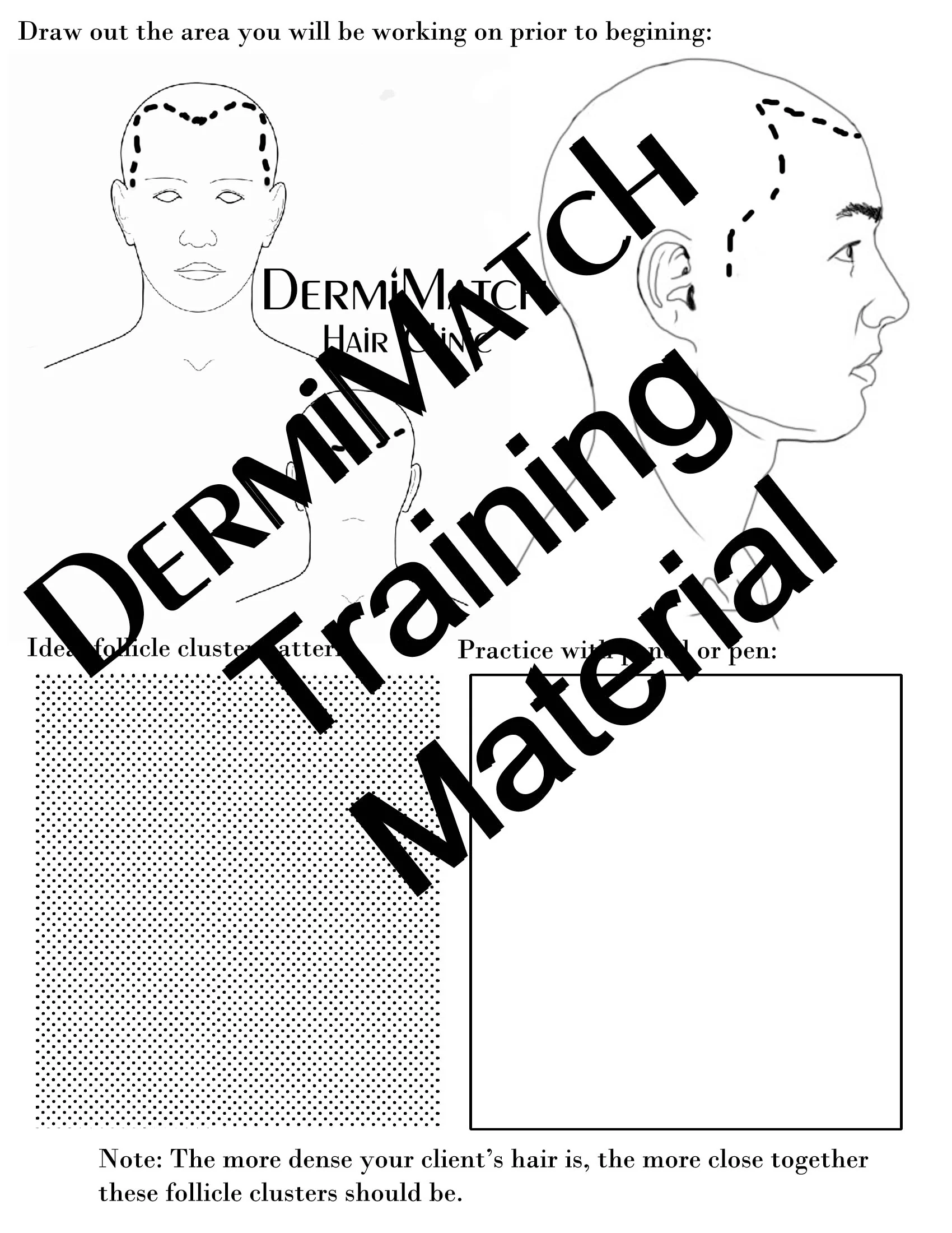 The DermMicro HD Pen - For Scalp Micropigmentation Professionals - Image 3