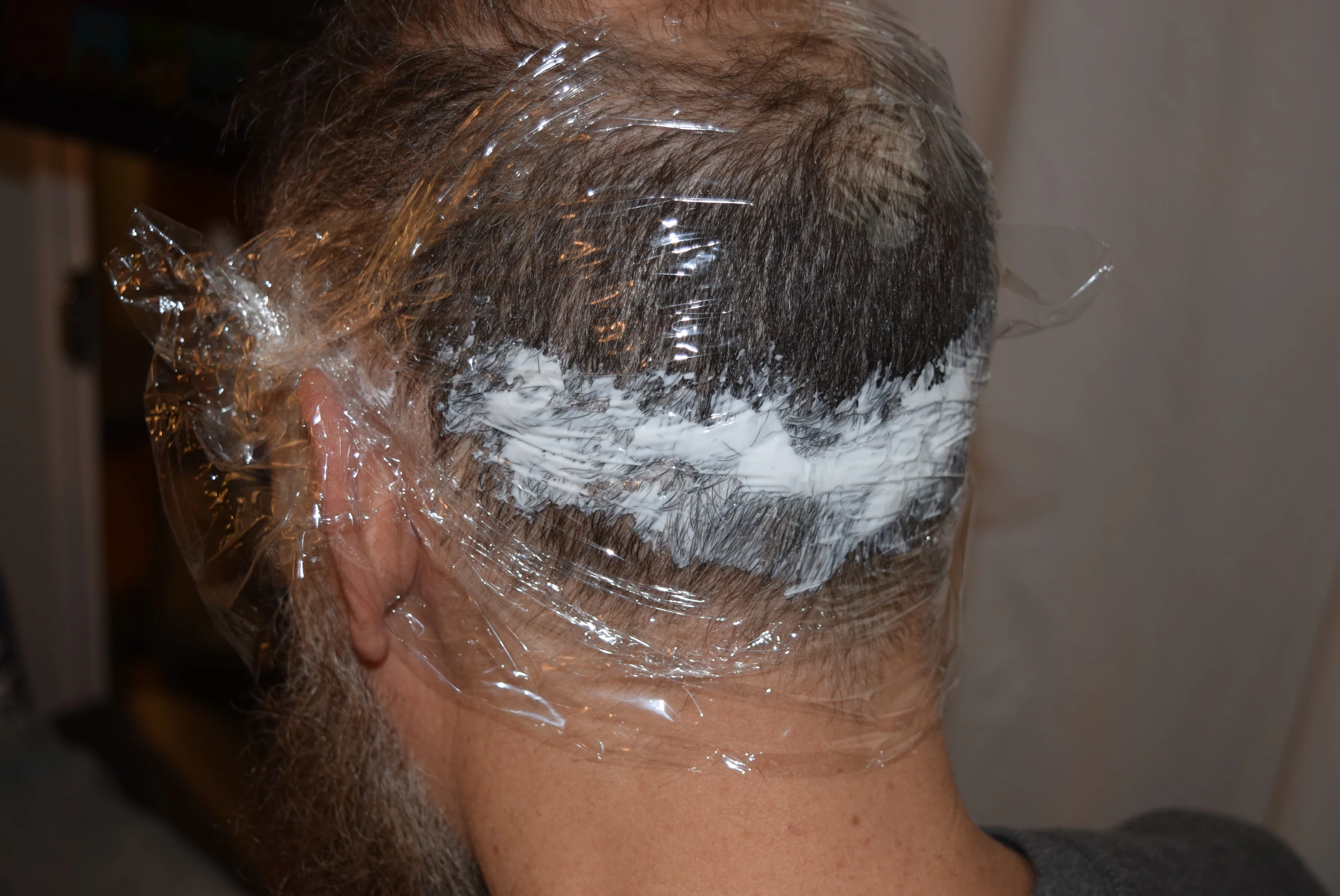 Scalp Numb by DermMicro - Image 3